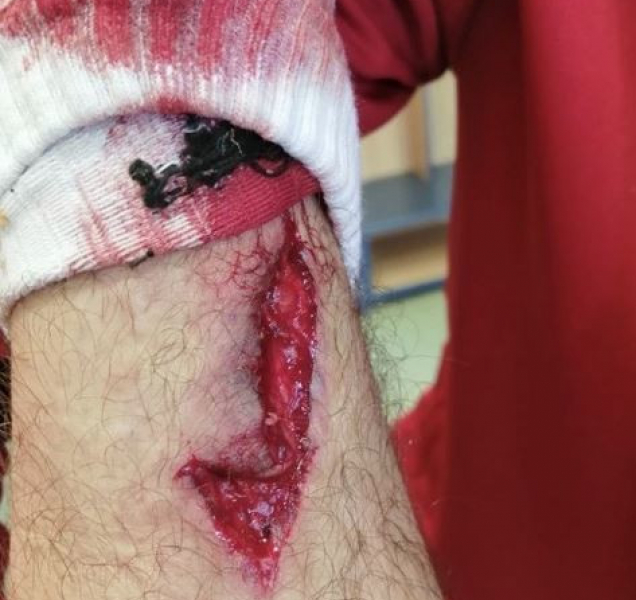 Sigmě budou chybět v neděli tři hráči